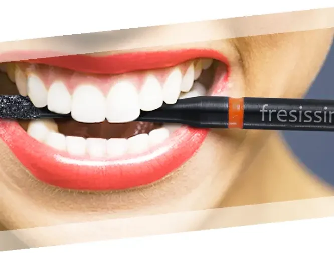 fresissima-layout-2-e1729606762544.webp